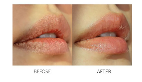 One Thing: Moisturizing Lip Essence (Esencia labial hidratante)